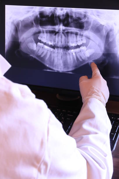 Best Emergency Root Canal Treatment in Lebanon, IL