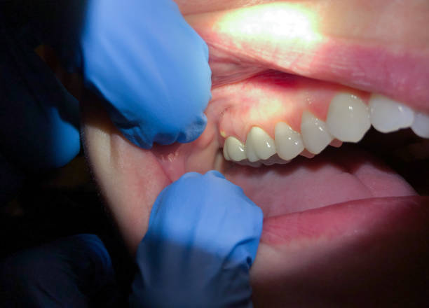 Best Mobile Emergency Dentist in Lebanon, IL