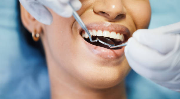 Best Emergency Dental Services for Seniors in Lebanon, IL