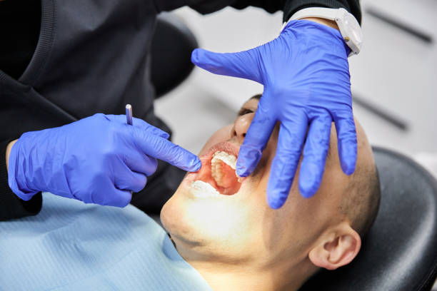 Best Emergency Dentist for Lost Fillings or Crowns in Lebanon, IL